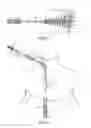 Fig. 02 - VASCULAR IMPLANT RETRIEVAL METHOD, RETRIEVAL ASSEMBLY AND TOOL FOR SAME