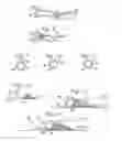 Fig. 03 - Distal protection device