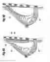 Fig. 04 - SOFT FILLED PROSTHESIS SHELL WITH DISCRETE FIXATION SURFACES