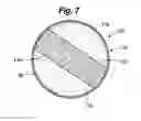 Fig. 06 - SOFT FILLED PROSTHESIS SHELL WITH DISCRETE FIXATION SURFACES