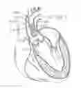 Fig. 04 - Retaining mechanisms for prosthetic heart valves
