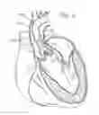 Fig. 05 - Retaining mechanisms for prosthetic heart valves