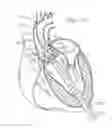 Fig. 07 - Retaining mechanisms for prosthetic heart valves