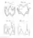 Fig. 11 - Retaining mechanisms for prosthetic heart valves
