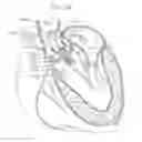Fig. 20 - Retaining mechanisms for prosthetic heart valves