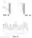 Fig. 16 - Cuff configurations for prosthetic heart valve