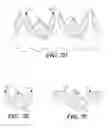 Fig. 17 - Cuff configurations for prosthetic heart valve