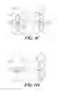 Fig. 20 - Cuff configurations for prosthetic heart valve