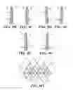 Fig. 22 - Cuff configurations for prosthetic heart valve