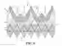 Fig. 24 - Cuff configurations for prosthetic heart valve