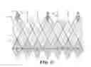 Fig. 25 - Cuff configurations for prosthetic heart valve