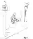 Fig. 03 - INTRAMEDULLARY DEVICE FOR TREATING PERIPROSTHETIC FRACTURES