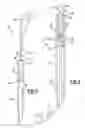 Fig. 05 - INTRAMEDULLARY DEVICE FOR TREATING PERIPROSTHETIC FRACTURES