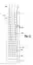 Fig. 09 - INTRAMEDULLARY DEVICE FOR TREATING PERIPROSTHETIC FRACTURES