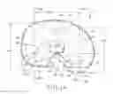 Fig. 02 - Tibial bearing component for a knee prosthesis with improved articular characteristics
