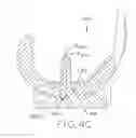 Fig. 13 - Tibial bearing component for a knee prosthesis with improved articular characteristics