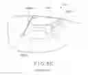 Fig. 19 - Tibial bearing component for a knee prosthesis with improved articular characteristics