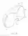 Fig. 20 - Tibial bearing component for a knee prosthesis with improved articular characteristics