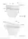 Fig. 24 - Tibial bearing component for a knee prosthesis with improved articular characteristics