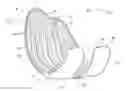 Fig. 01 - LOW PROFILE KNEE IMPLANT