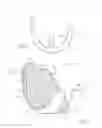 Fig. 03 - LOW PROFILE KNEE IMPLANT