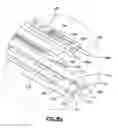 Fig. 14 - Device for expanding and supporting body tissue