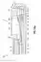 Fig. 23 - Device for expanding and supporting body tissue