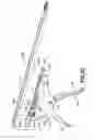 Fig. 30 - Device for expanding and supporting body tissue