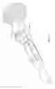 Fig. 21 - Implant device having curved or arced struts