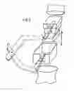 Fig. 03 - VERTEBRAL BODY REPLACEMENT