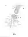 Fig. 03 - Vertebral body replacement