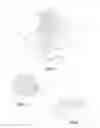 Fig. 04 - Vertebral body replacement