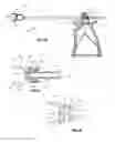 Fig. 25 - Vertebral body replacement