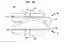 Fig. 08 - Intervertebral disc and insertion methods therefor