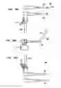 Fig. 17 - Intervertebral disc and insertion methods therefor
