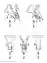 Fig. 27 - Intervertebral disc and insertion methods therefor