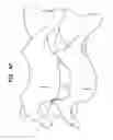 Fig. 36 - Intervertebral disc and insertion methods therefor