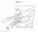 Fig. 41 - Intervertebral disc and insertion methods therefor