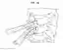 Fig. 42 - Intervertebral disc and insertion methods therefor