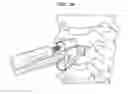 Fig. 44 - Intervertebral disc and insertion methods therefor