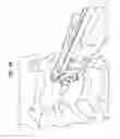Fig. 52 - Intervertebral disc and insertion methods therefor