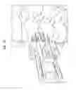 Fig. 65 - Intervertebral disc and insertion methods therefor