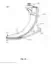 Fig. 02 - COMPRESSION HEEL PROSTHETIC FOOT
