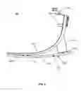 Fig. 05 - COMPRESSION HEEL PROSTHETIC FOOT
