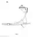 Fig. 09 - COMPRESSION HEEL PROSTHETIC FOOT