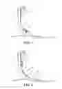 Fig. 02 - Prosthetic device, system and method for increasing vacuum attachment