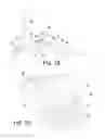 Fig. 07 - Prosthetic device, system and method for increasing vacuum attachment