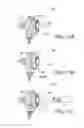 Fig. 10 - Prosthetic device, system and method for increasing vacuum attachment