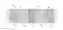 Fig. 01 - Method for making a flexible stent-graft