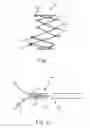 Fig. 06 - Protuberant aneurysm bridging device deployment method